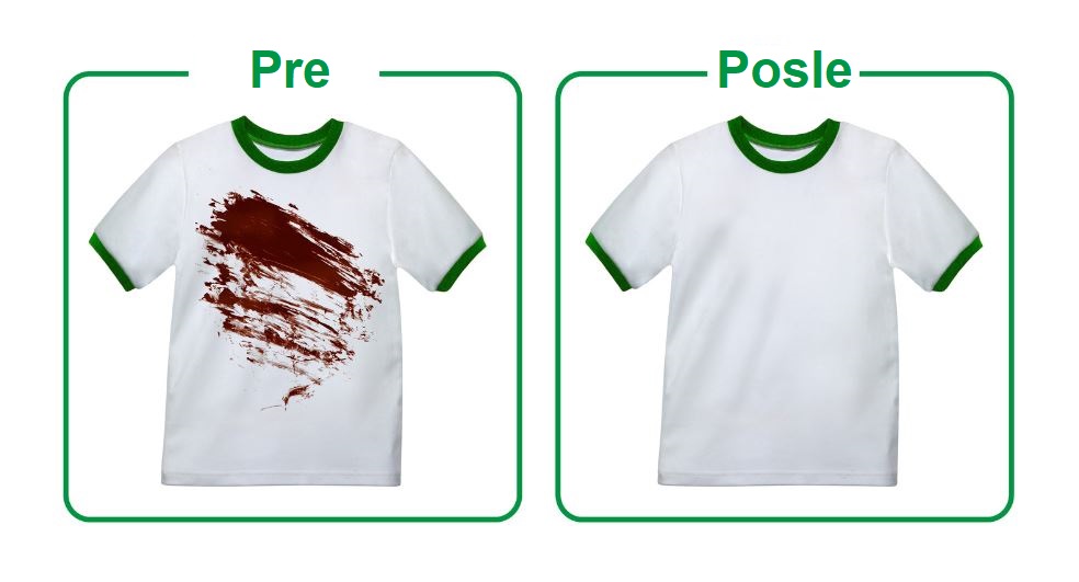 Pre-Posle
